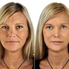 Retinol & Vitamin C Brightening Serum | Anti-Aging Face Serum 1 fl oz